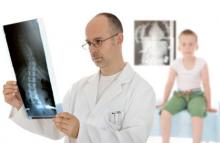 aches-pains-scoliosis.jpg